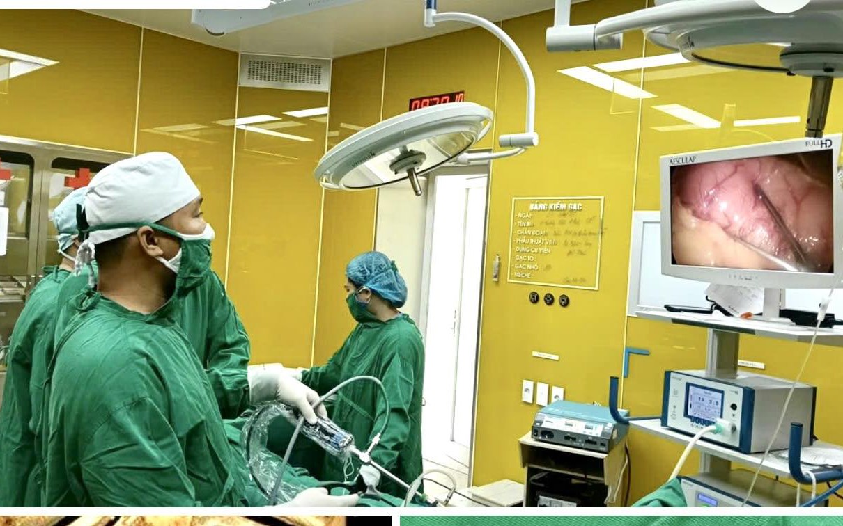 Nam sinh lớp 10 Hải Phòng bị thủng dạ dày hiếm gặp- Ảnh 2. Người đàn ông 68 tuổi bị dị vật kim loại xuyên thủng dạ dày vào tụy