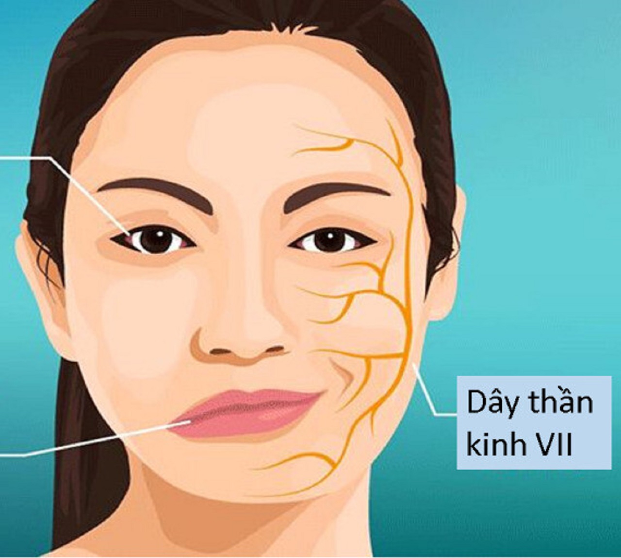 Phòng ngừa liệt dây thần kinh số VII- Ảnh 1. Phòng ngừa liệt dây thần kinh số VII- Ảnh 1.
