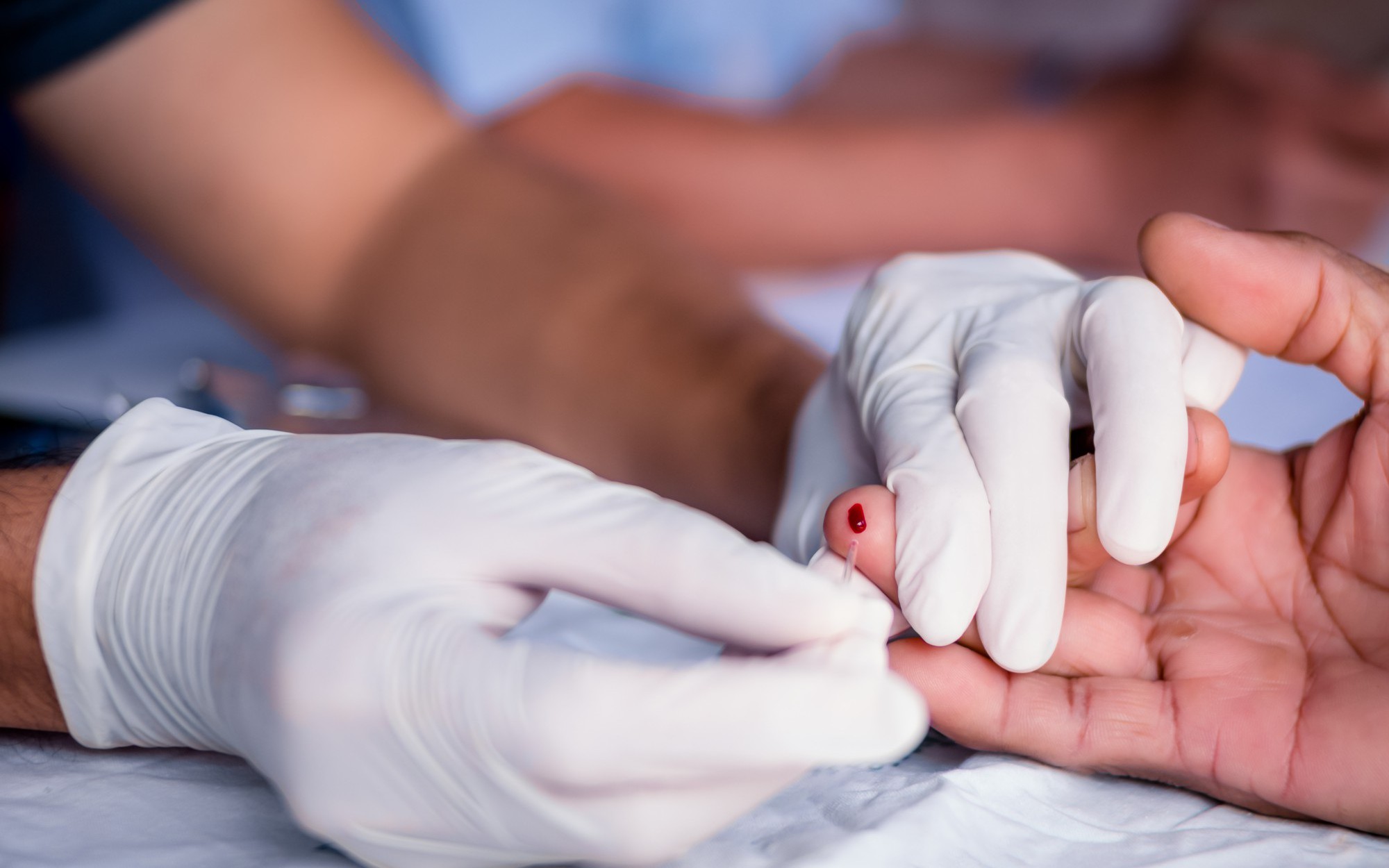 Xét nghiệm HIV có được bảo mật không?