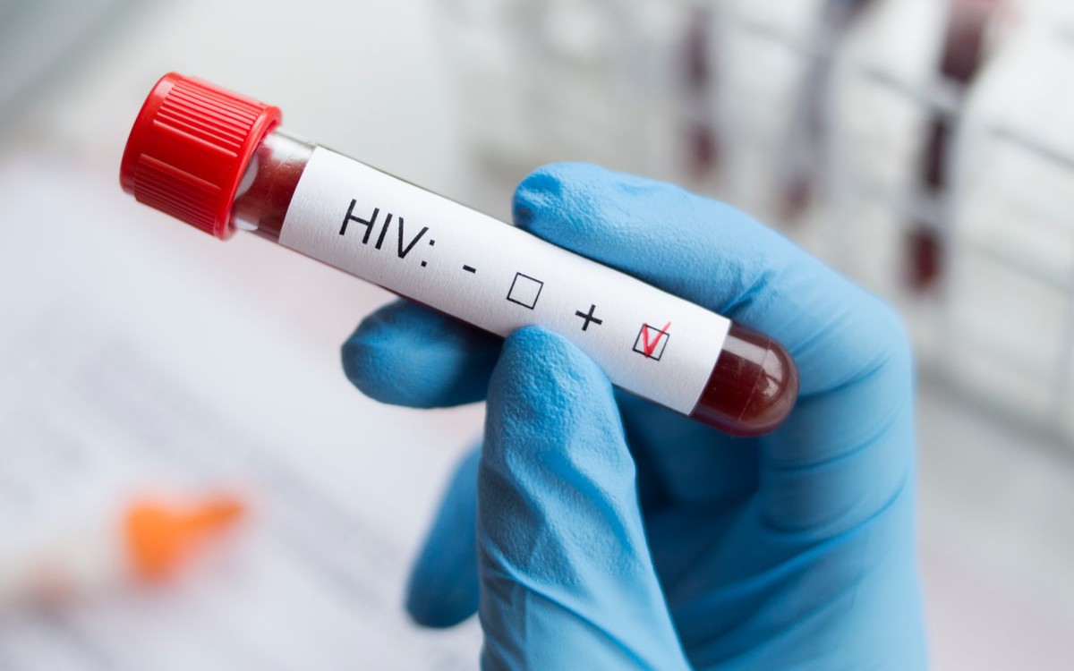 xet nghiem hiv 2 1761534184321407580397 268 0 1018 1200 crop 17615341884891012818740