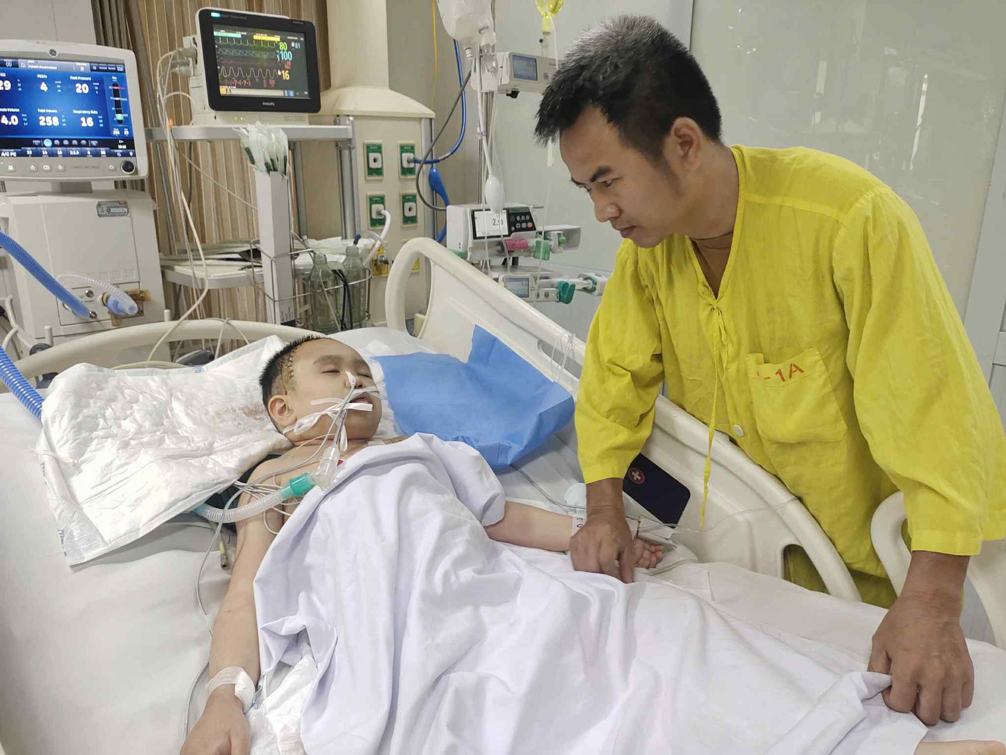 Xót thương hoàn cảnh bé gái mắc bệnh u não cần sự hỗ trợ từ cộng đồng- Ảnh 2. Xót thương hoàn cảnh bé gái mắc bệnh u não cần sự hỗ trợ từ cộng đồng- Ảnh 2.