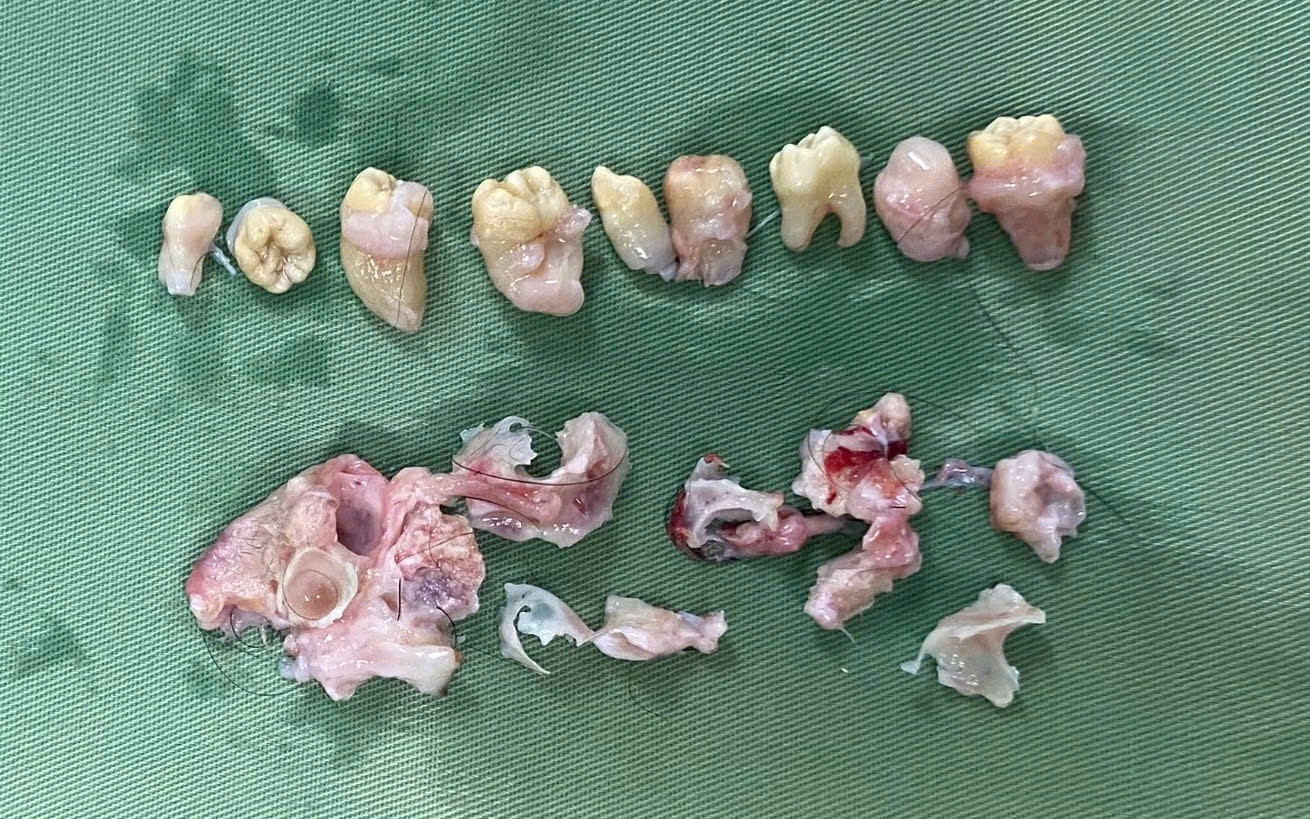 Hy hữu: Bác sĩ phẫu thuật 
