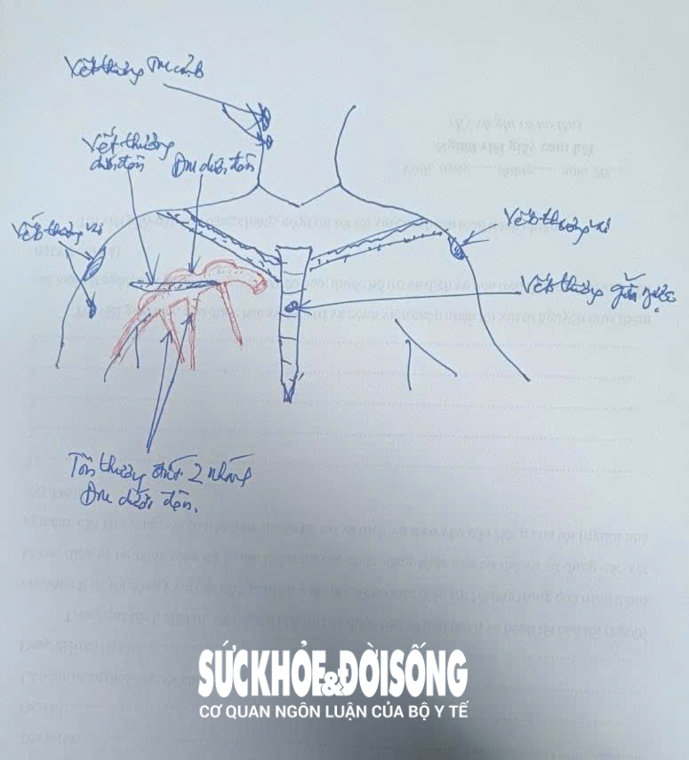 Thứ trưởng Trần Văn Thuấn: Nhân viên y tế không mang thân phận công quyền, nhưng cứu người là "thi hành nghĩa vụ công"- Ảnh 2. Thứ trưởng Trần Văn Thuấn: Nhân viên y tế không mang thân phận công quyền, nhưng cứu người là "thi hành nghĩa vụ công"- Ảnh 2.