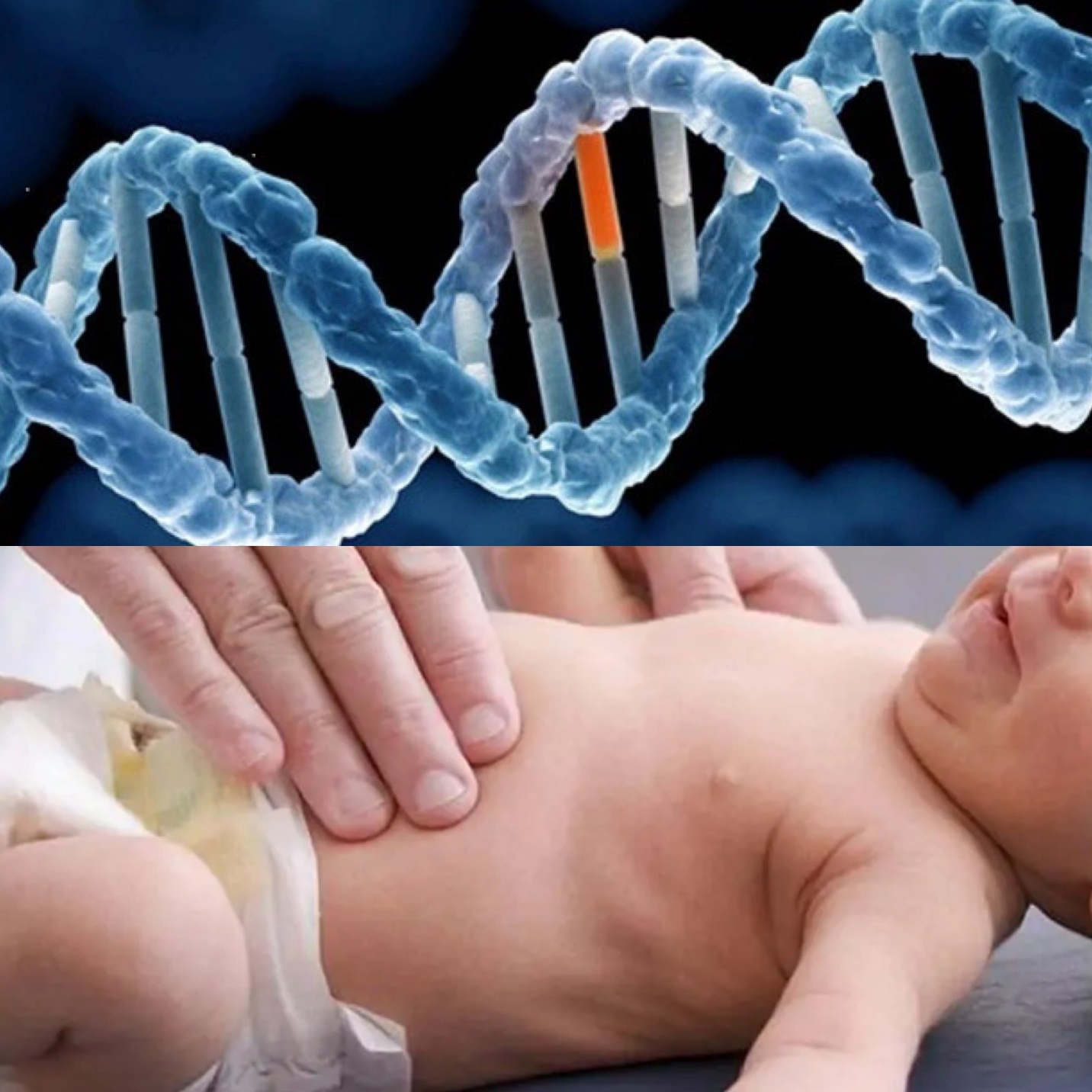 Rối loạn chuyển hoá bẩm sinh có chữa khỏi được không?- Ảnh 1. Cần sàng lọc rối loạn chuyển hóa bẩm sinh, tránh nguy cơ tử vong cho trẻ