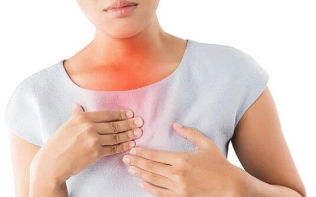 Ợ nóng có đáng lo ngại, khi nào cần đi khám? - Ảnh 2.