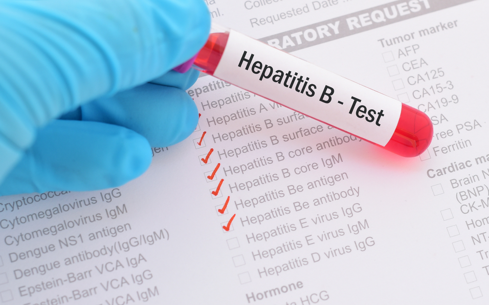 Điều trị đồng nhiễm HIV: Bảo vệ sức khỏe và nâng cao chất lượng cuộc sống
