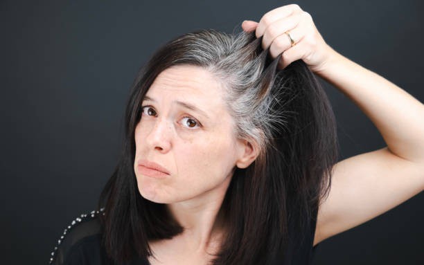 Tóc bạc sớm không chỉ do tuổi tác, mà do thiếu những dưỡng chất này