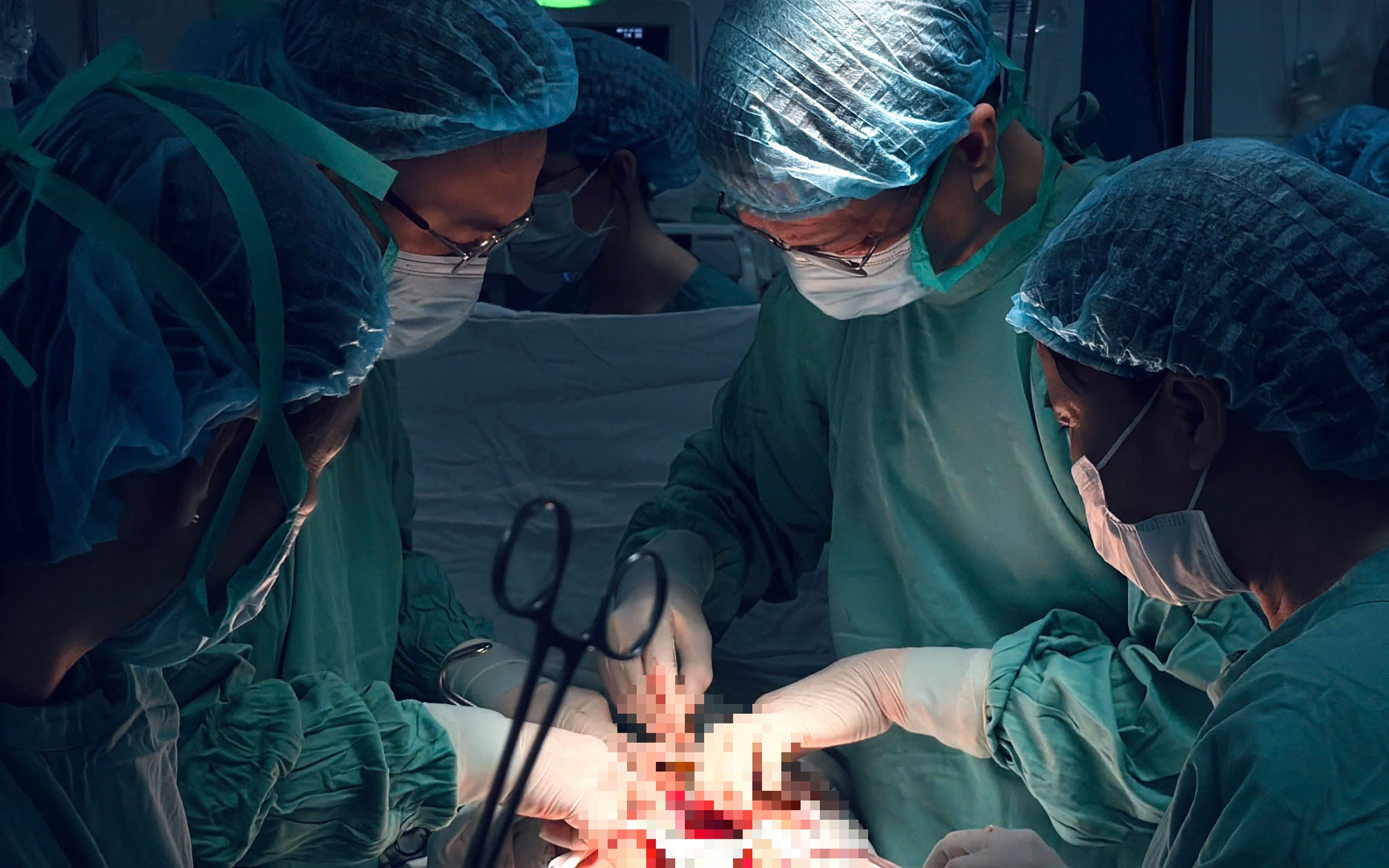 Ca phẫu thuật khẩn cấp trong mưa lũ cứu sống sản phụ ở Huế