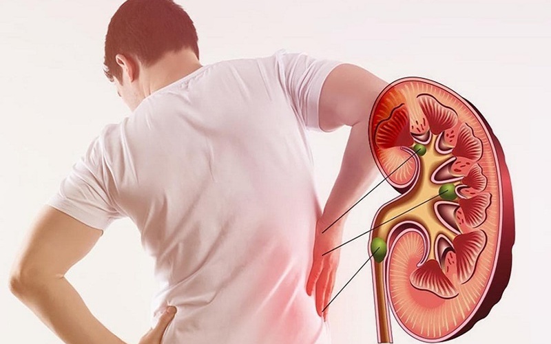 benh than 1 17632199498061401977839 29 0 529 800 crop 17632200604251875951117