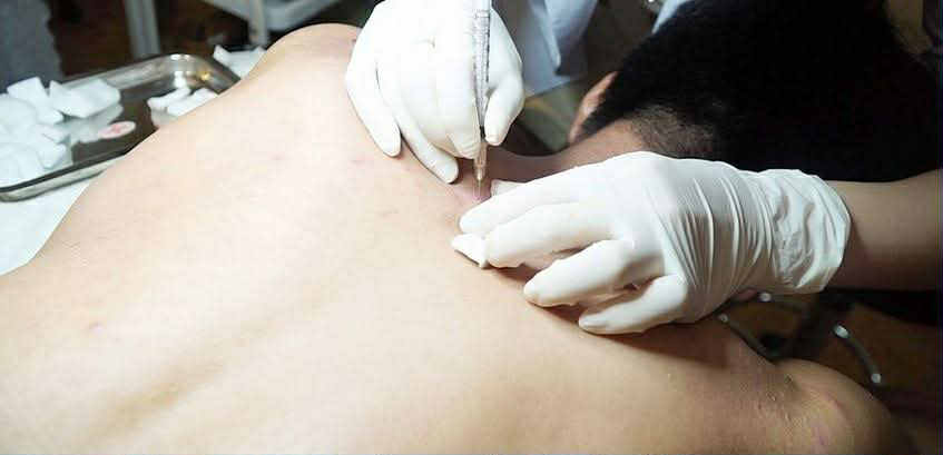 Uventet smerte etter å ha blitt smittet med HIV fra en spabehandling - Bilde 3. Nỗi đau không thể ngờ sau khi nhiễm H từ một lần làm đẹp tại spa- Ảnh 3.