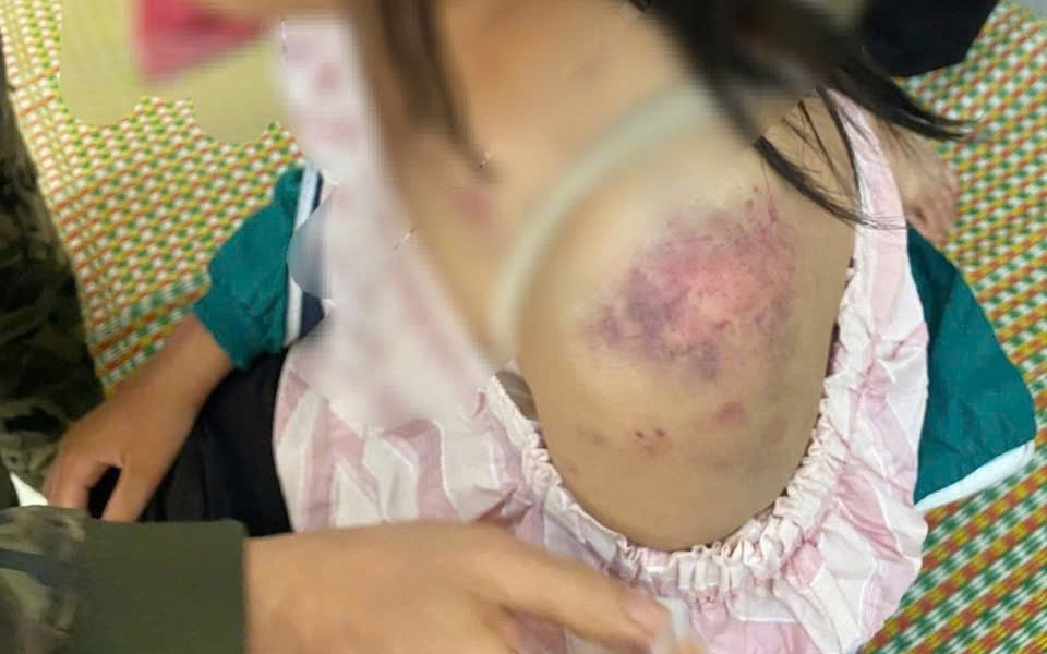 Khởi tố, bắt tạm giam 3 đối tượng bạo hành cháu bé tại Thái Nguyên- Ảnh 3.