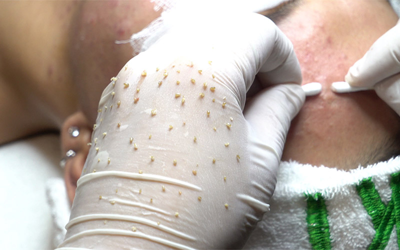 Uventet smerte etter å ha blitt smittet med HIV fra en spabehandling - Bilde 2. Nỗi đau không thể ngờ sau khi nhiễm H từ một lần làm đẹp tại spa- Ảnh 2.