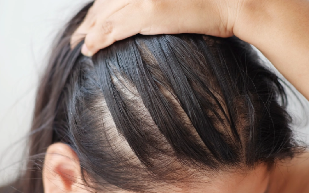 Bí quyết ngăn rụng tóc và kích thích tóc mọc nhanh tại nhà