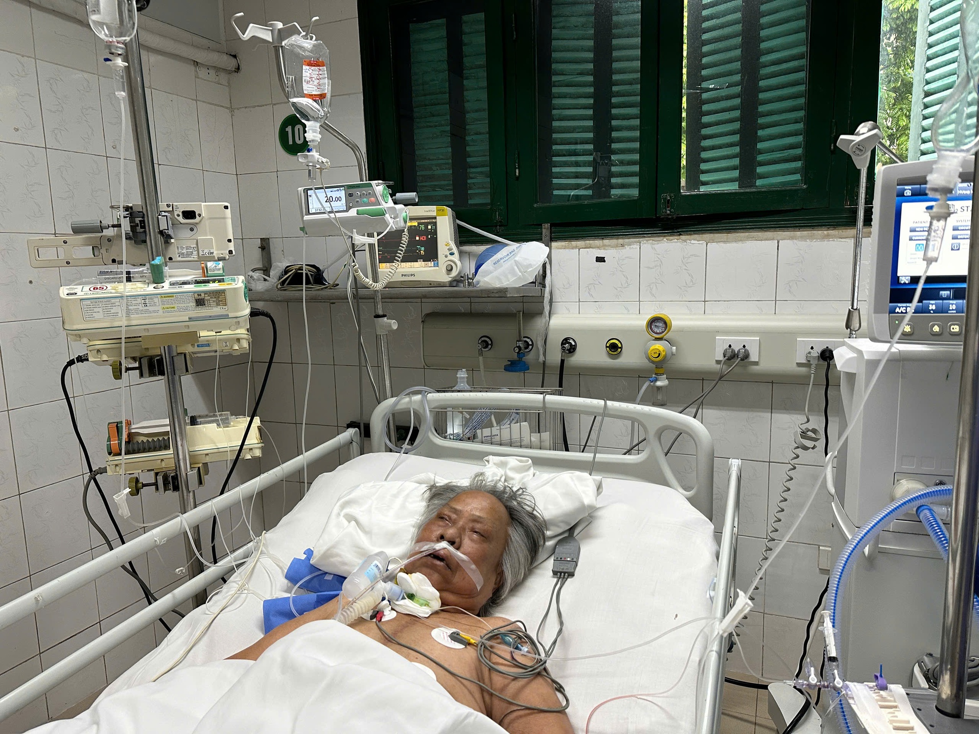 Người phụ nữ nghèo phẫu thuật nhiều lần vì bệnh tim, kinh tế khánh kiệt cần sự trợ giúp- Ảnh 2.