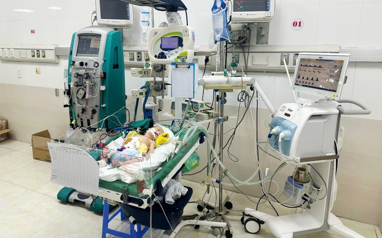 Cứu sống trẻ sơ sinh bị sốc nhiễm khuẩn do viêm phúc mạc, thủng ruột