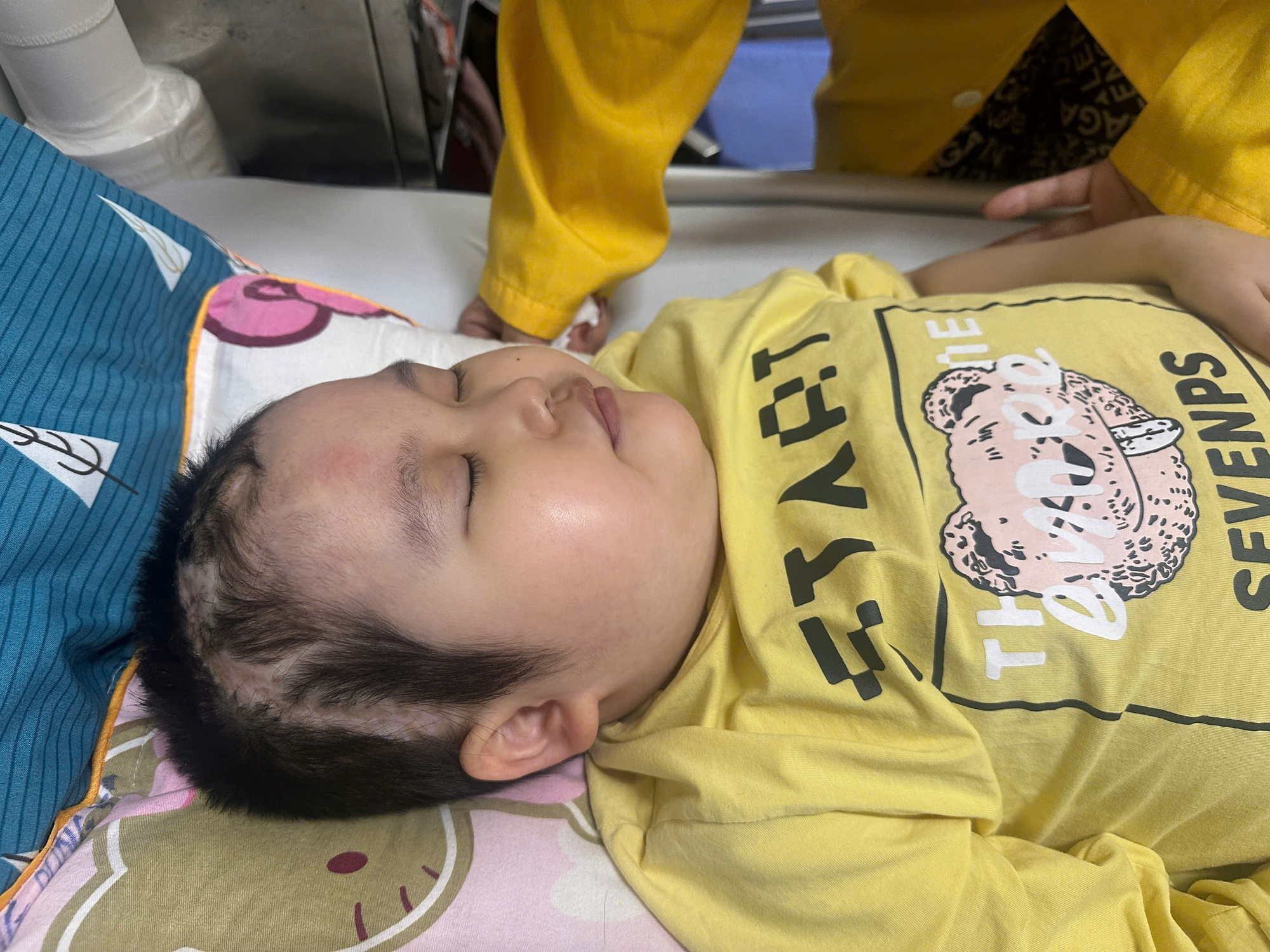 Xót xa hoàn cảnh của bé gái 7 tuổi ở Cao Bằng với hành trình 6 năm chiến đấu với căn bệnh quái ác- Ảnh 1.