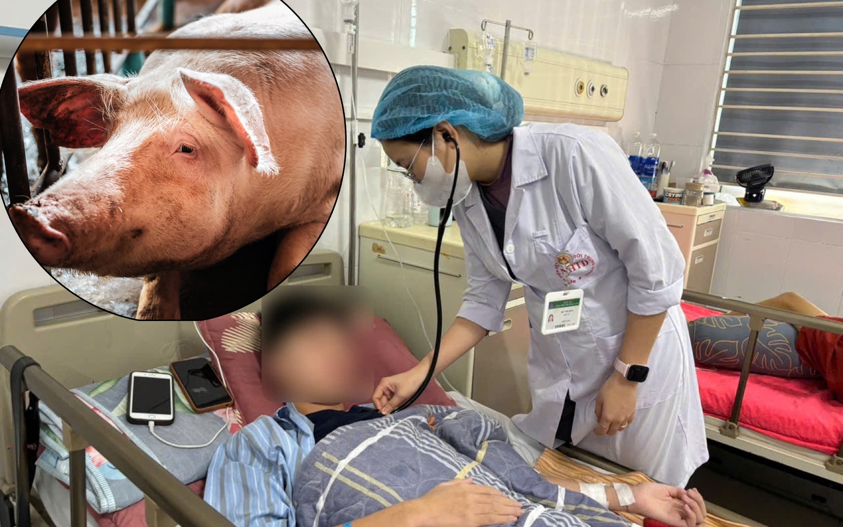 Cụ ông 65 tuổi mù mờ mắt, biến chứng nguy hiểm do giang mai thần kinh- Ảnh 1.