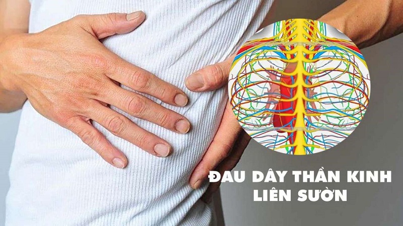 Ai có nguy cơ bị đau dây thần kinh liên sườn?- Ảnh 1. Ai có nguy cơ bị đau dây thần kinh liên sườn?- Ảnh 1.