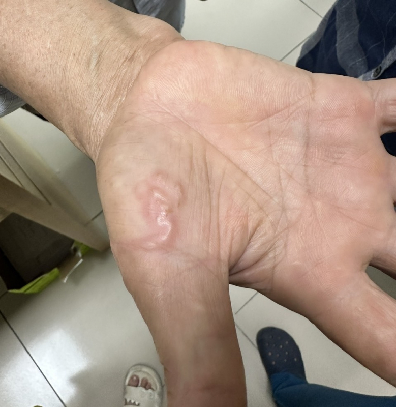 ອາການຂອງແມ່ທ້ອງຕ້ອງໄປພົບແພດໄວ, ໄປກວດຢູ່ໃສ? - ຮູບ 2. Biểu hiện mắc giun sán cần đi khám sớm, khám ở đâu?- Ảnh 2.