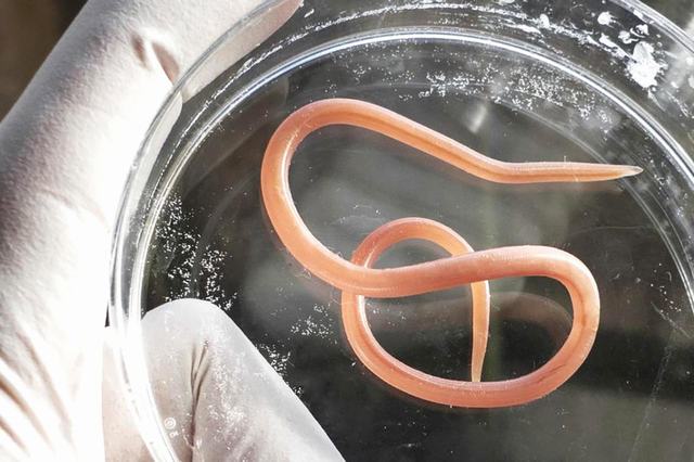 Bệnh giun đũa: nguyên nhân, triệu chứng và điều trị