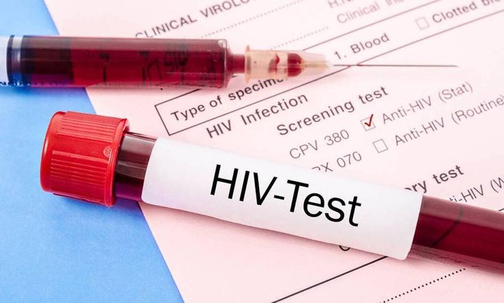 Thực trạng HIV/AIDS ở Việt Nam: Dịch đã được kiểm soát nhưng chưa thể chủ quan- Ảnh 2. Thực trạng HIV/AIDS ở Việt Nam: Dịch đã được kiểm soát nhưng chưa thể chủ quan- Ảnh 2.