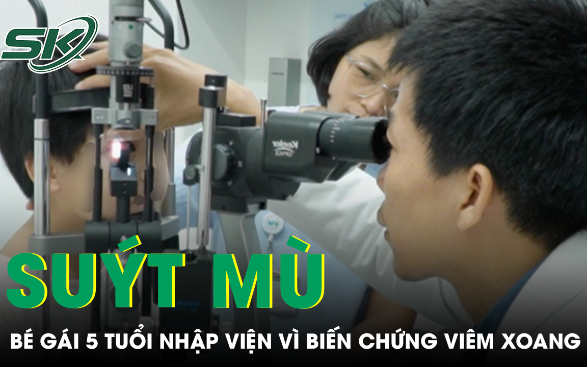 Cảnh báo nguy hiểm từ trường hợp viêm xoang nhẹ đến biến chứng hủy xương trán- Ảnh 2.