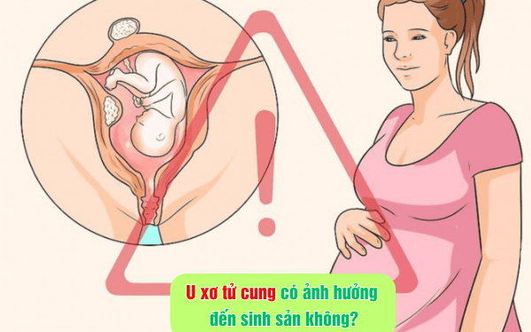 U xơ tử cung có ảnh hưởng đến sinh sản không?