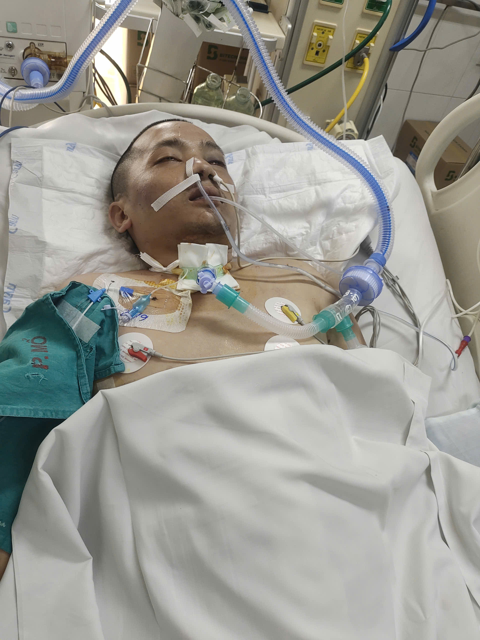 Nam thanh niên nguy kịch vì tai nạn giao thông trên đường đi mua thuốc cho bố nằm liệt đang rất cần sự giúp đỡ- Ảnh 1. Nam thanh niên nguy kịch vì tai nạn giao thông trên đường đi mua thuốc cho bố nằm liệt đang rất cần sự giúp đỡ- Ảnh 1.