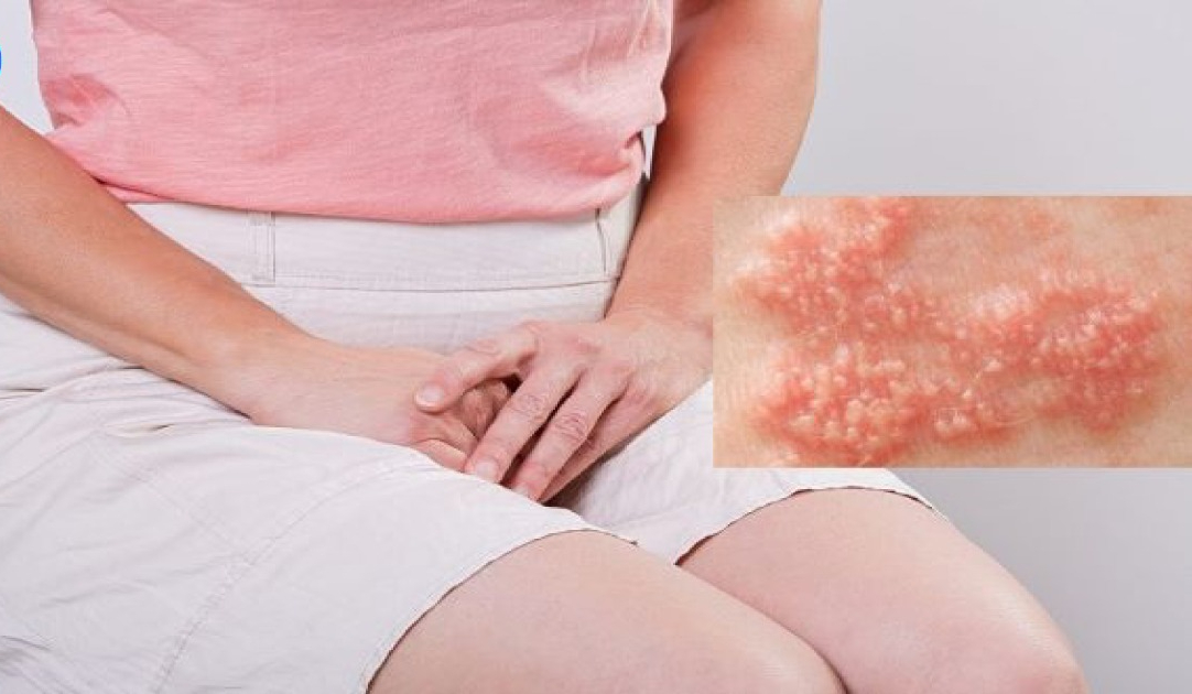 Nhiều trẻ vị thành niên mắc bệnh tình dục do quan hệ sớm- Ảnh 1. Nhiều trẻ vị thành niên mắc bệnh tình dục do quan hệ sớm- Ảnh 1.