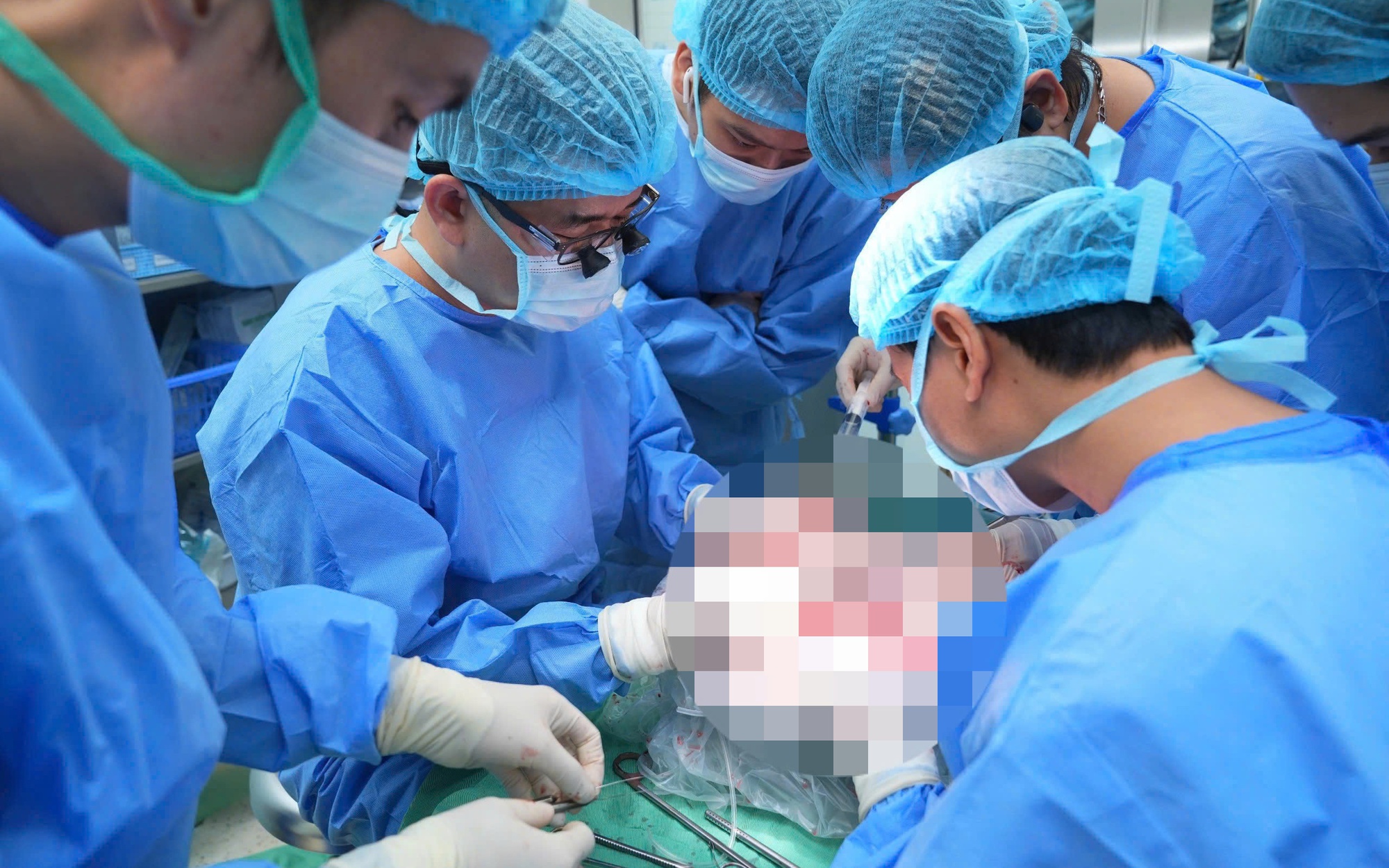 Bệnh nhân mắc viêm gan B, ung thư gan tái phát được cứu nhờ ghép gan từ vợ hiến tặng