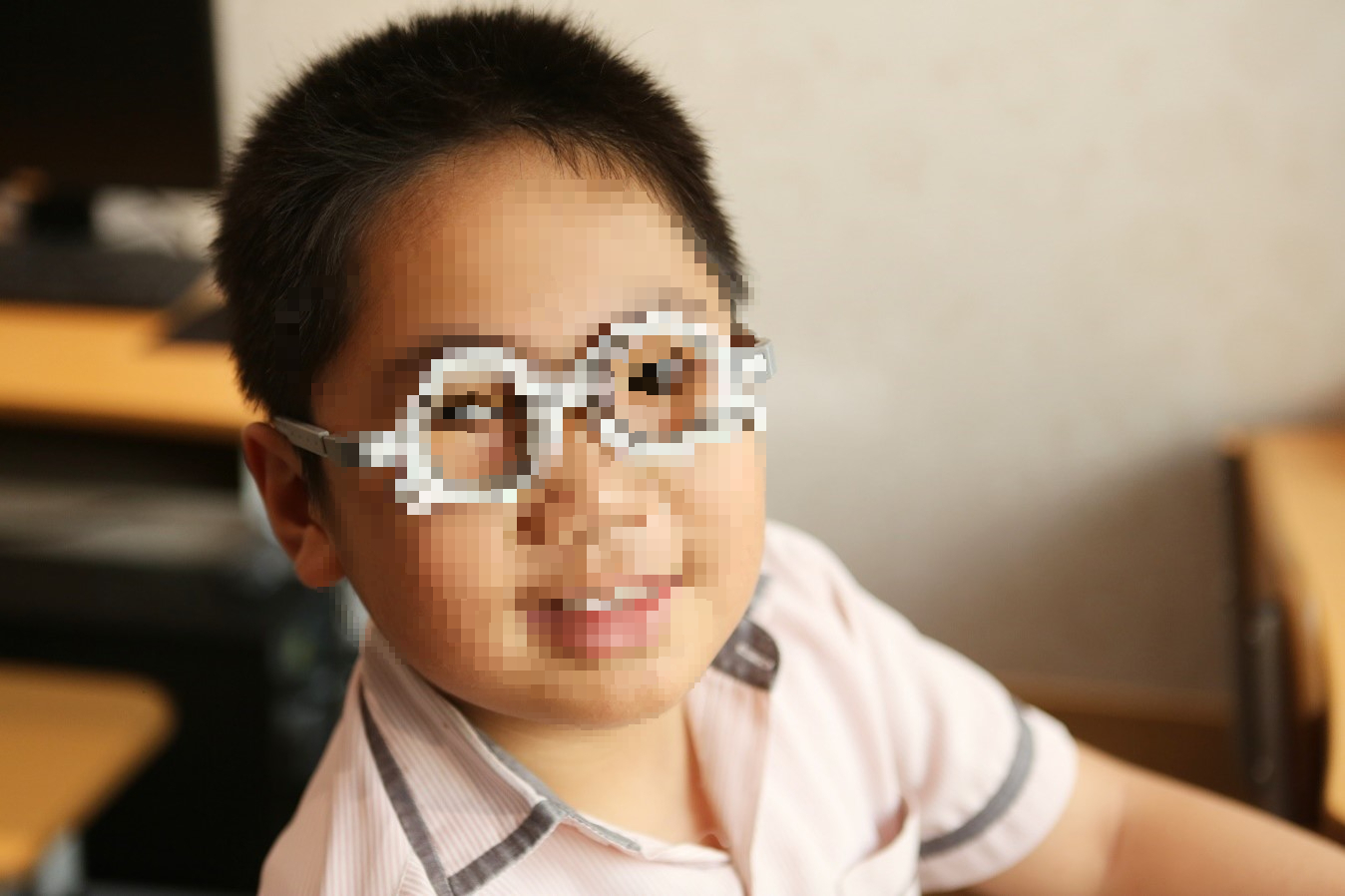 Trẻ không than mờ mắt nhưng có thể mất thị lực vĩnh viễn do nhược thị- Ảnh 2. Trẻ không than mờ mắt nhưng có thể mất thị lực vĩnh viễn do nhược thị- Ảnh 2.