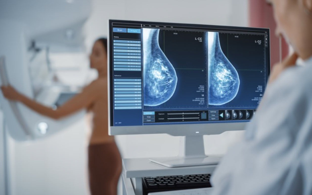 Tầm soát ung thư rẻ tiền vẫn hiệu quả- Ảnh 3. Tầm soát ung thư: Khi nào là cần, khi nào là lạm dụng?