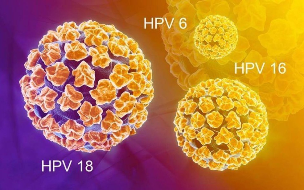 Chủng virus HPV nào dễ gây ung thư cổ tử cung nhất?