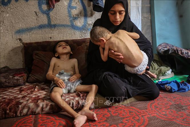 Hàng nghìn trẻ em ở Gaza nhập viện vì suy dinh dưỡng cấp tính- Ảnh 1. Hàng nghìn trẻ em ở Gaza nhập viện vì suy dinh dưỡng cấp tính- Ảnh 1.