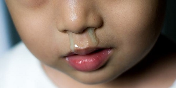 Khói bụi, điều hòa quá lạnh hoặc không khí khô đều làm mũi trẻ tăng tiết dịch. Ảnh minh hoạ Khói bụi, điều hòa quá lạnh hoặc không khí khô đều làm mũi trẻ tăng tiết dịch. Ảnh minh hoạ