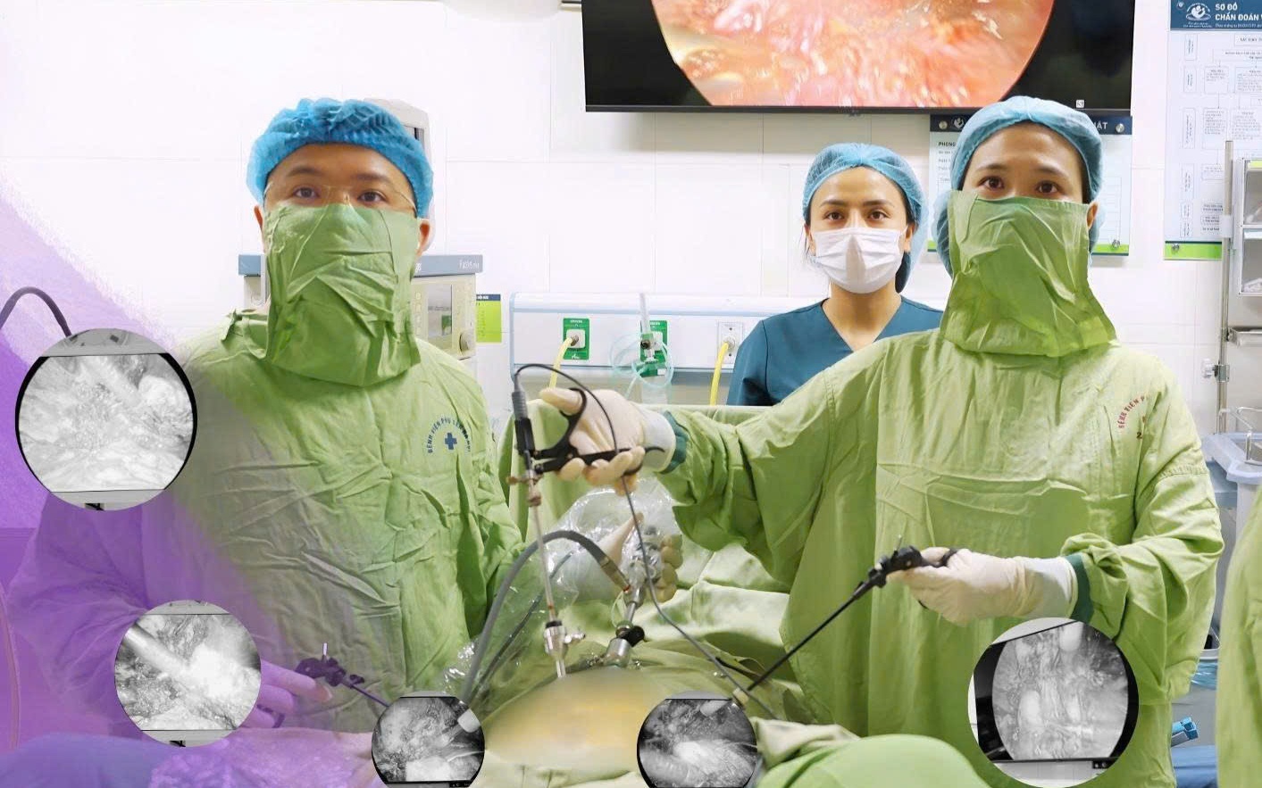 6 dấu hiệu nghi ngờ mắc u xơ tử cung- Ảnh 4.