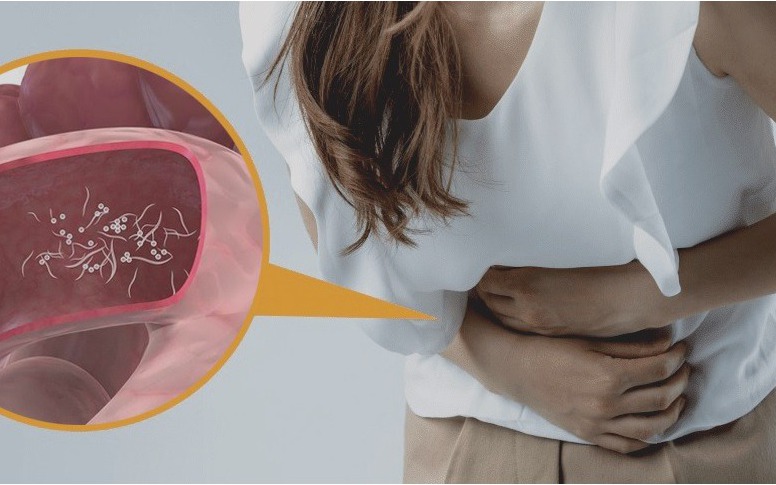 Cứu sống giảng viên nước ngoài nguy kịch vì viêm phổi, sốc nhiễm khuẩn nặng- Ảnh 3.