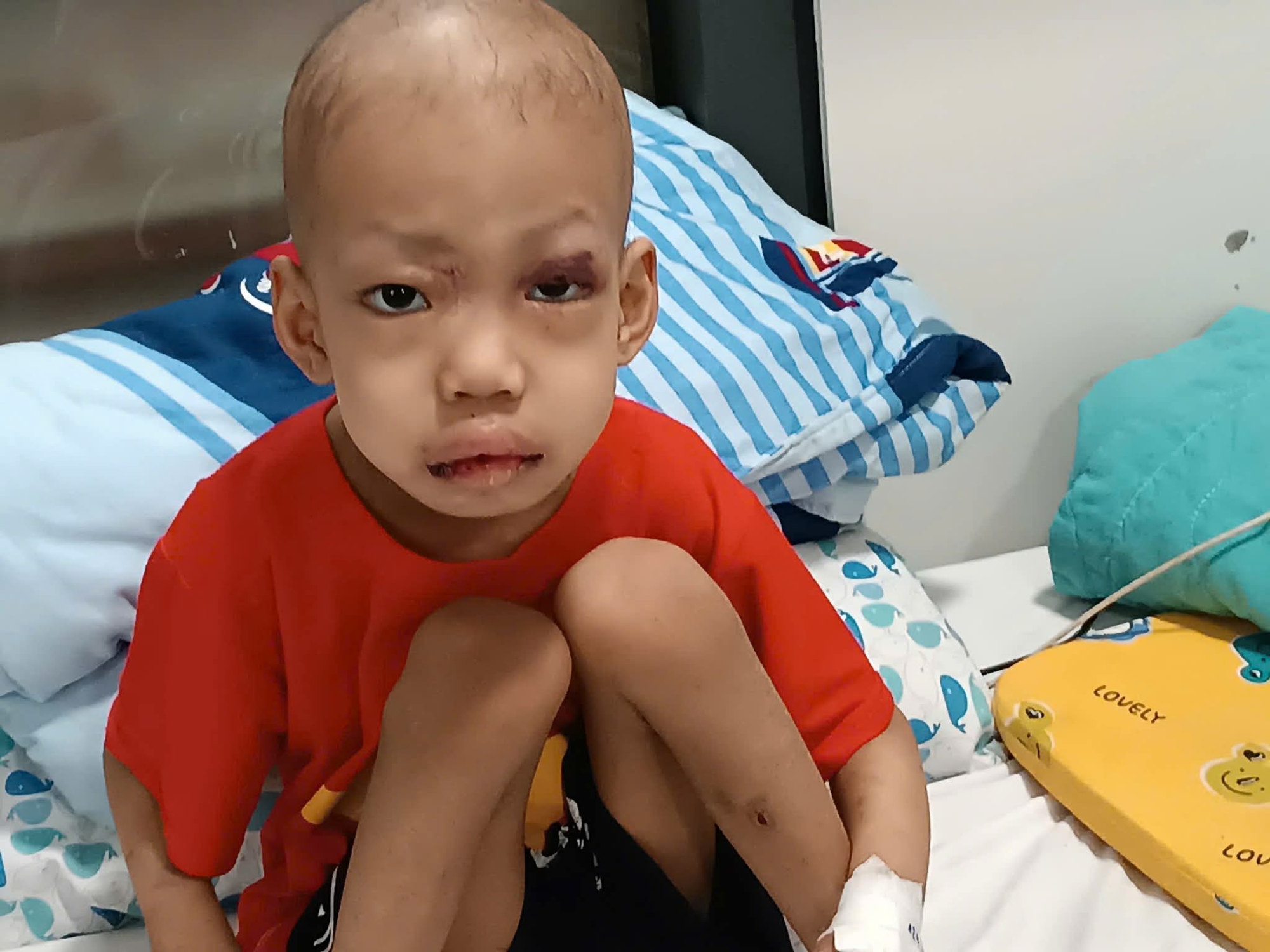 Xót xa cảnh gia đình 3 người cùng bệnh cần cộng đồng giúp đỡ- Ảnh 1. Xót xa cảnh gia đình 3 người cùng bệnh cần cộng đồng giúp đỡ- Ảnh 1.