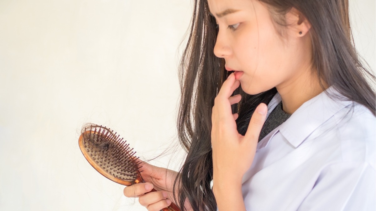 Rụng tóc ồ ạt, vuốt là rụng: Khi nào cần đi khám?- Ảnh 2. Rụng tóc ồ ạt, vuốt là rụng: Khi nào cần đi khám?- Ảnh 2.