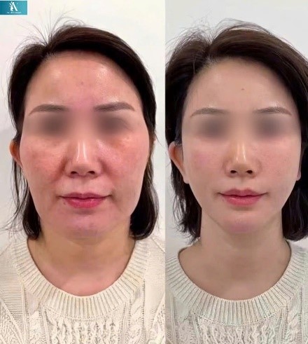 Bác sĩ trẻ Hà Nội mang kỹ thuật trẻ hóa 'không sẹo' ra mắt tại Hội thi kỹ thuật sáng tạo- Ảnh 5. Bác sĩ trẻ Hà Nội mang kỹ thuật trẻ hóa 'không sẹo' ra mắt tại Hội thi kỹ thuật sáng tạo- Ảnh 5.