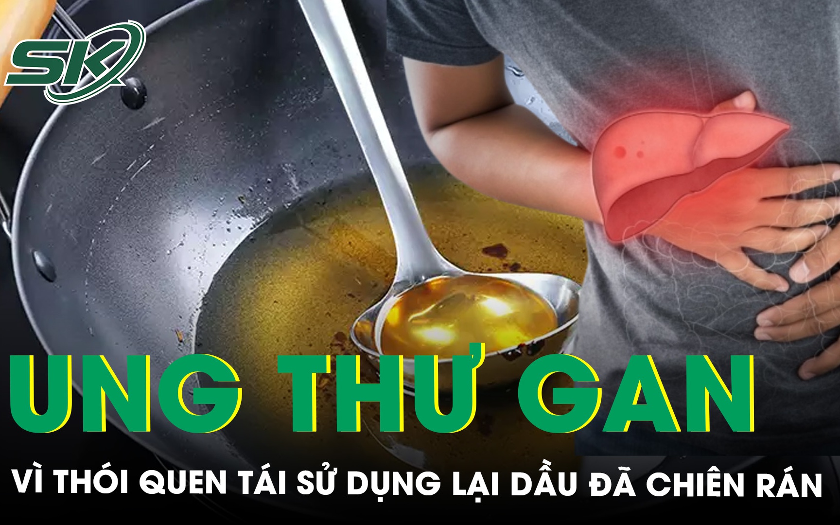 Người đàn ông mắc ung thư gan vì thói quen tái sử dụng dầu đã chiên rán 