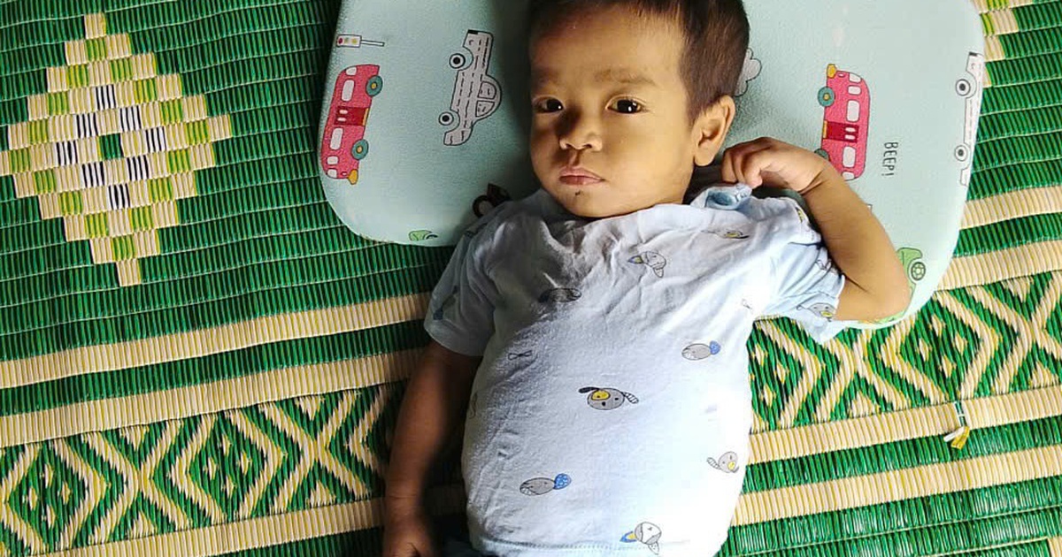 Nam sinh viên hiến gan cứu giảng viên thoát cửa tử vì suy gan cấp- Ảnh 3.