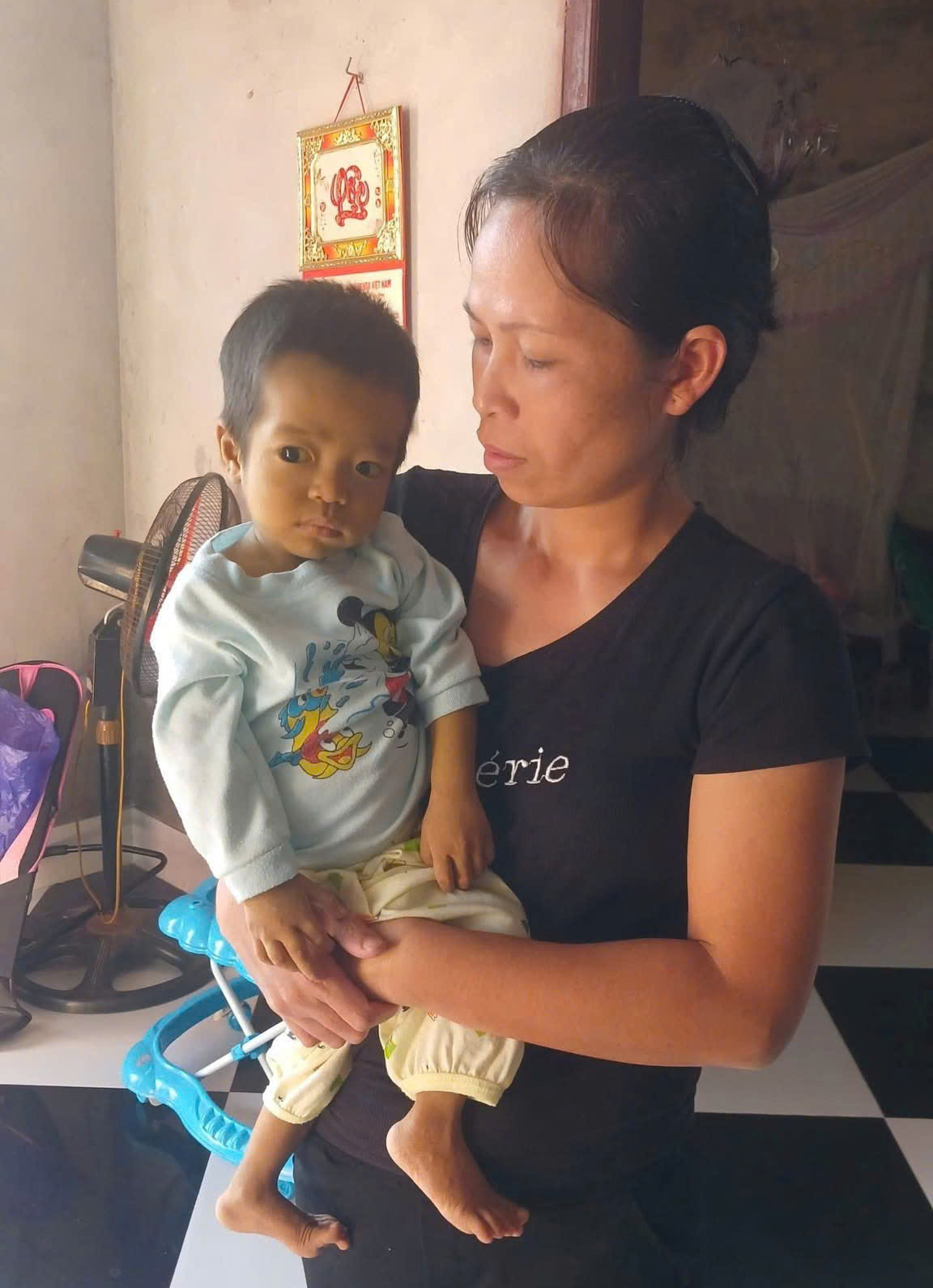 Xót xa hoàn cảnh bé trai bị teo mật bẩm sinh, mẹ sẵn sàng hiến gan cứu con nhưng không đủ kinh phí điều trị- Ảnh 2. Xót xa hoàn cảnh bé trai bị teo mật bẩm sinh, mẹ sẵn sàng hiến gan cứu con nhưng không đủ kinh phí điều trị- Ảnh 2.