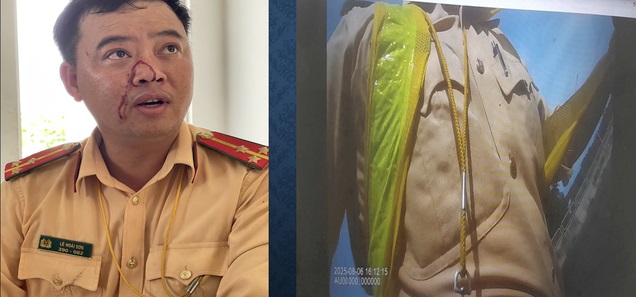 Cái giá đắt cho hành vi thông chốt và chống người thi hành công vụ tại Lâm Đồng- Ảnh 2. Cái giá đắt cho hành vi thông chốt và chống người thi hành công vụ tại Lâm Đồng- Ảnh 2.