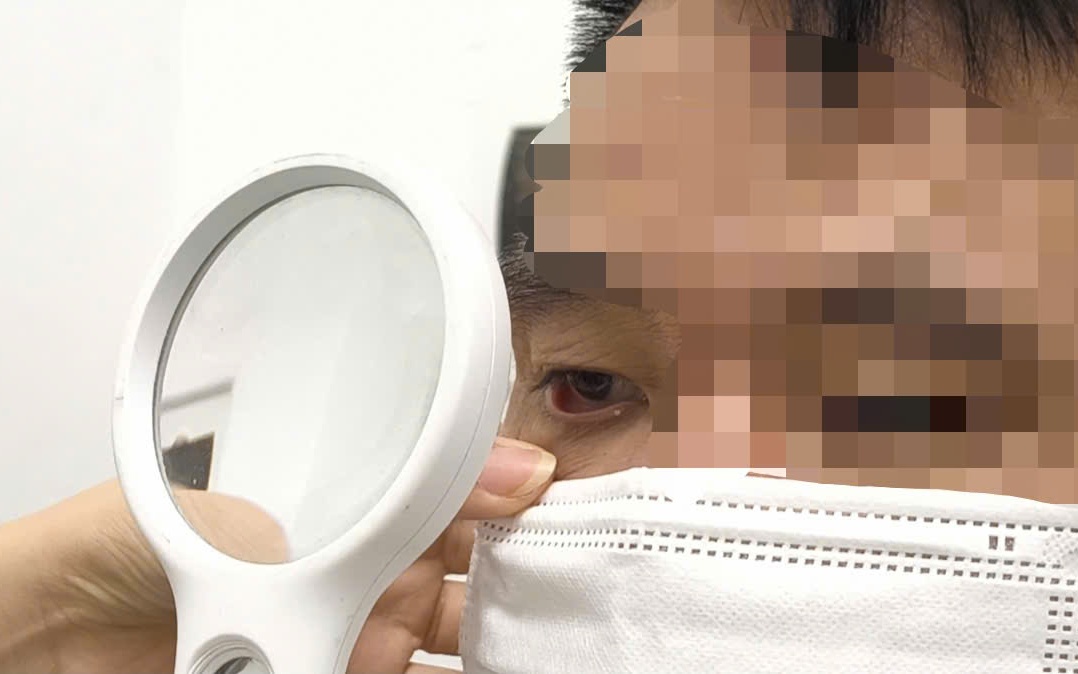 Sán dây chó làm tổ trong não suýt nhầm với u não- Ảnh 1.