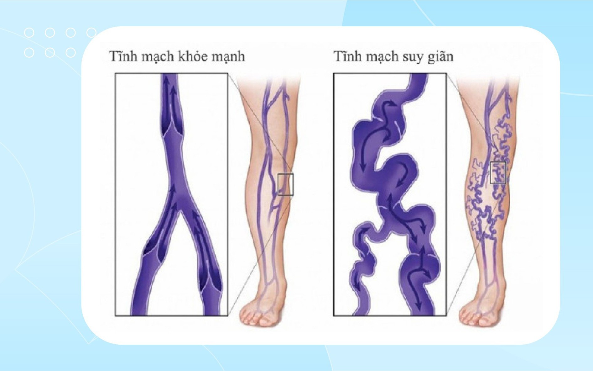 suy tinh mach chi 17661300437681859680245 0 6 1183 1899 crop 17661300486081414661501