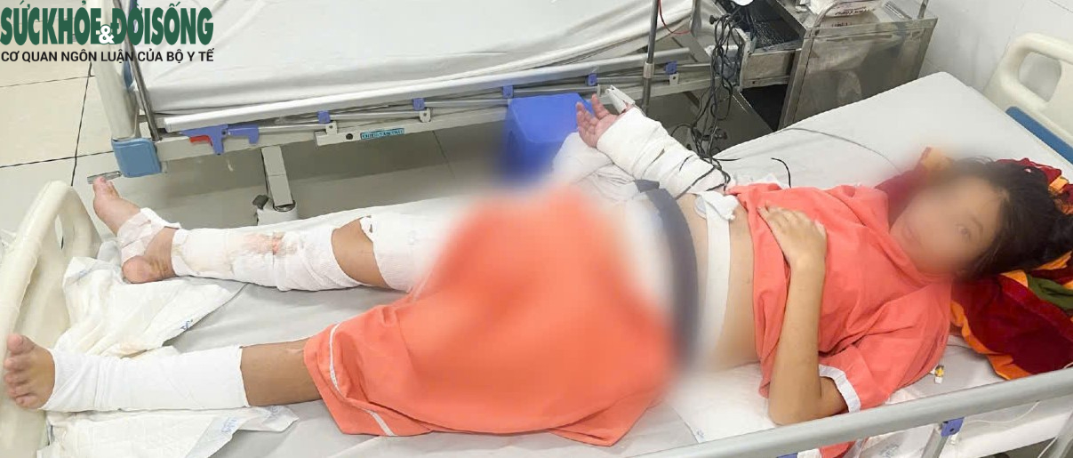 Bác sĩ Võ Thái Trung, BVĐK Bình Dương kể về ca ghép tạm bàn tay vào chân hiếm gặp, cứu mẹ và hai thai nhi- Ảnh 4.