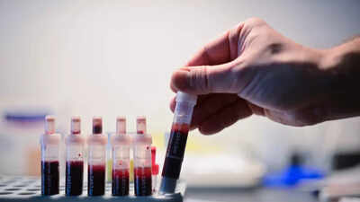 Liệu có phương pháp chữa khỏi HIV? Một nghiên cứu nhỏ cho thấy một hướng đi đầy hứa hẹn