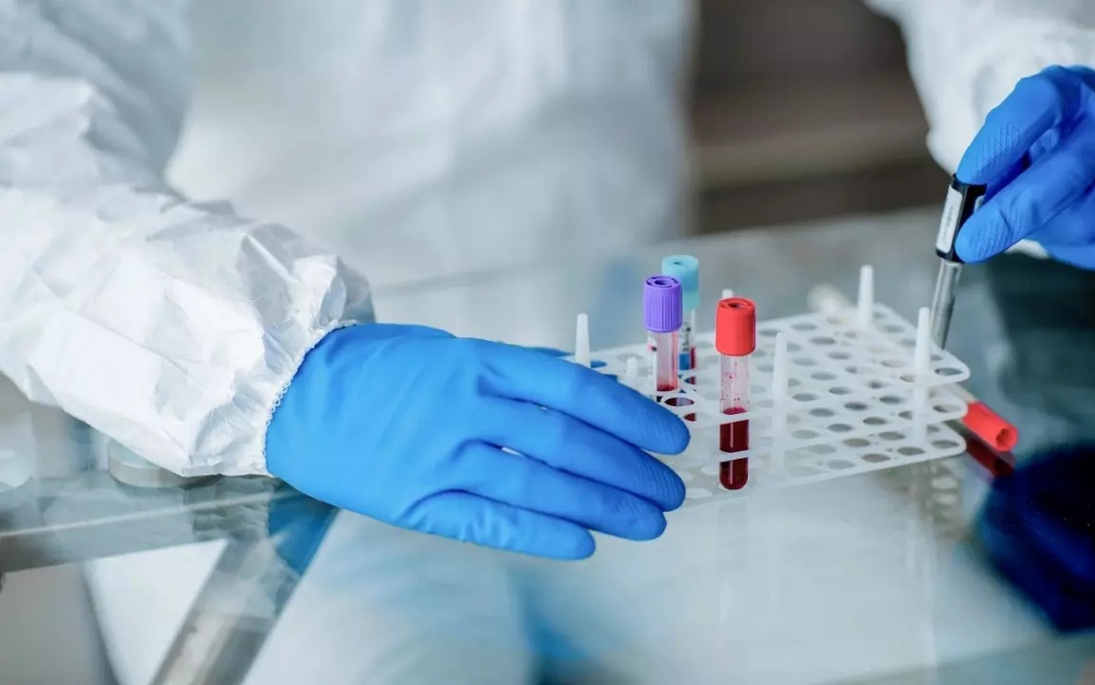 Liệu có phương pháp chữa khỏi HIV? Nghiên cứu mới mở ra hy vọng kiểm soát virus không cần dùng thuốc hàng ngày