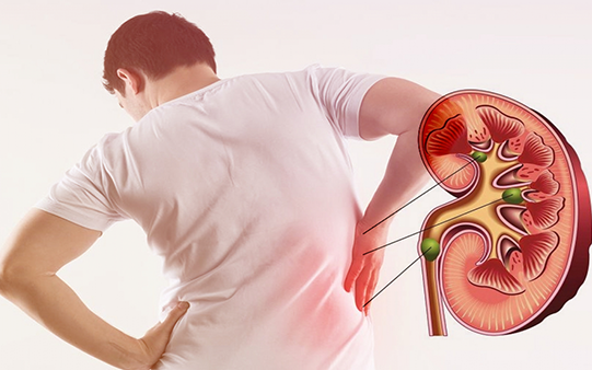 5 loại thực phẩm giúp thận lọc độc tố hiệu quả- Ảnh 2. 7 tác nhân âm thầm gây tổn thương thận không nên bỏ qua